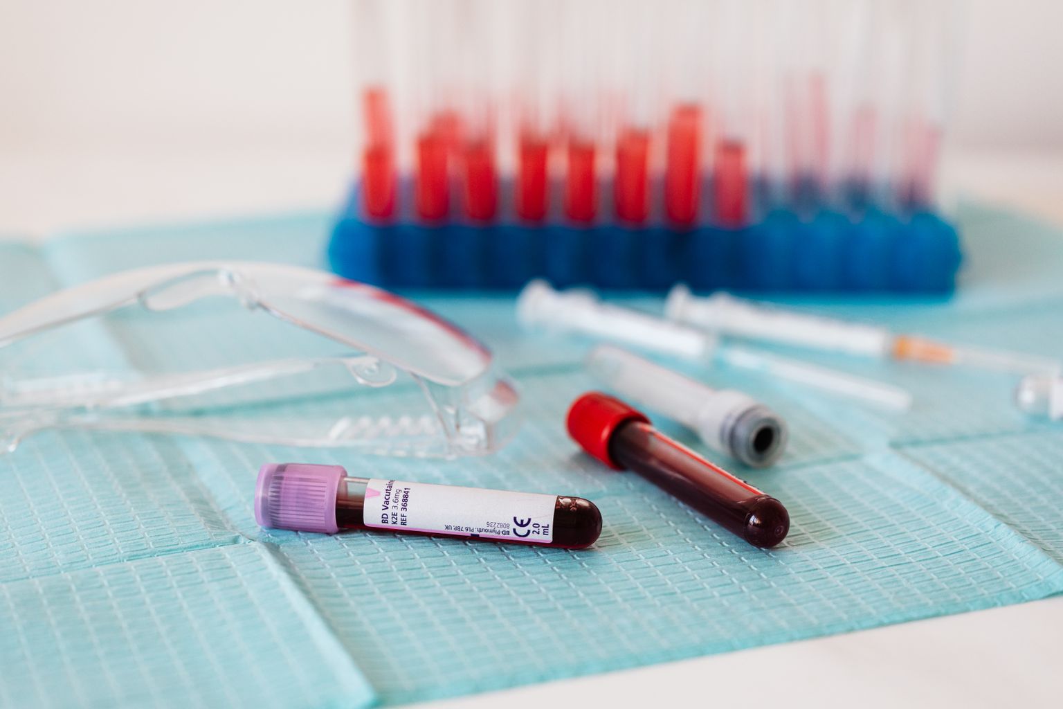 Tubos con muestras de sangre para análisis de glucemia y hemoglobina glicosilada en el laboratorio